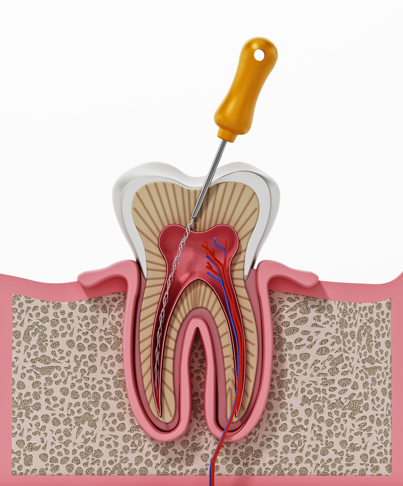 Endodonti